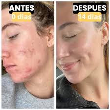 CREMA DE SEBO DE RES EVIL GOODS